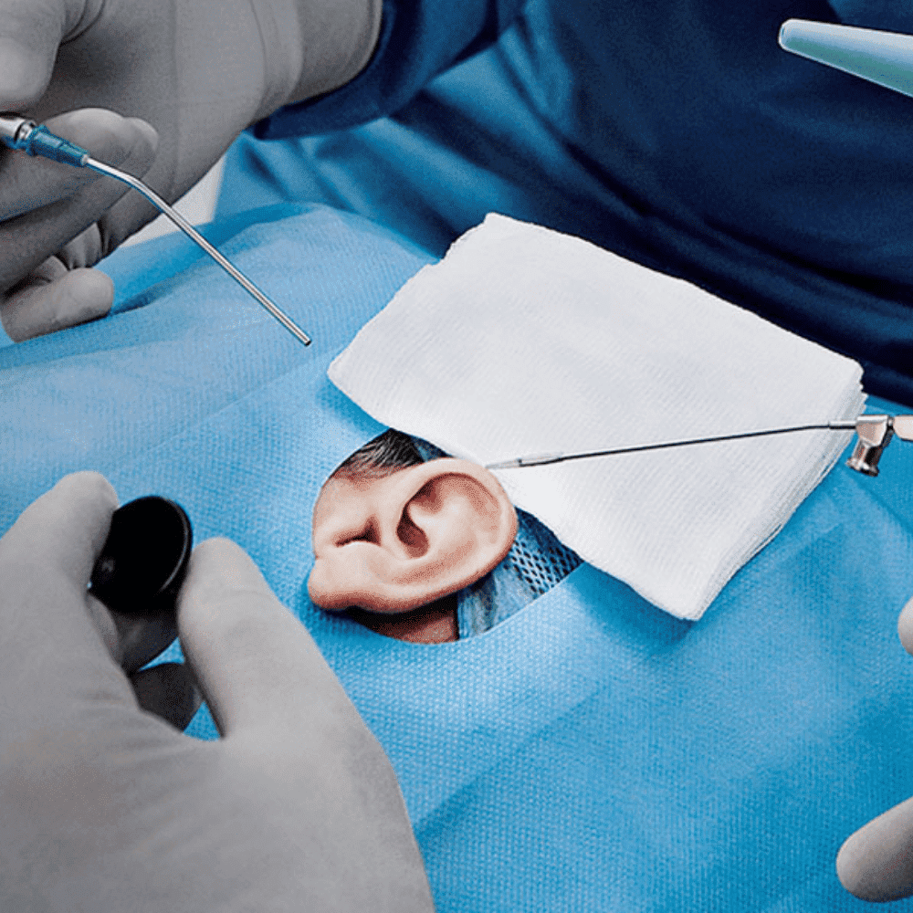 Cirurgia otorrinolaringologia - CGO Clínica